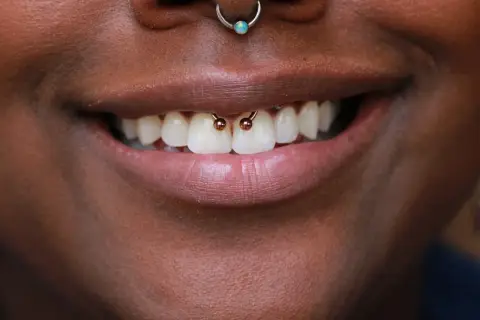 Uśmiechnięte usta z widocznym smiley piercingiem między zębami.