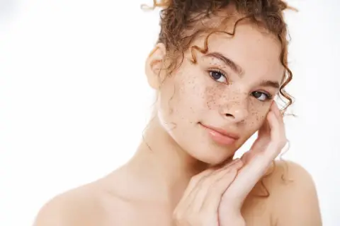 Joven con pecas en la cara, su significado es belleza natural y autenticidad.
