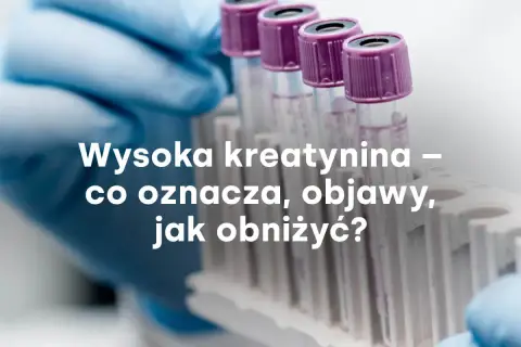 Rękawiczka laboratoryjna trzyma probówki. Tekst: Wysoka kreatynina – co oznacza, objawy, jak obniżyć?