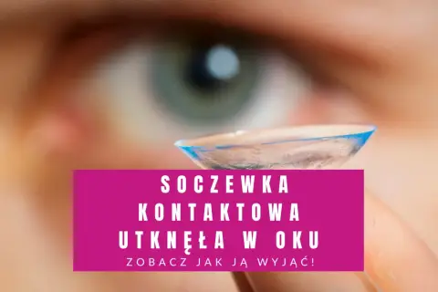 Co zrobić jak soczewka utknie w oku - skuteczne metody usunięcia