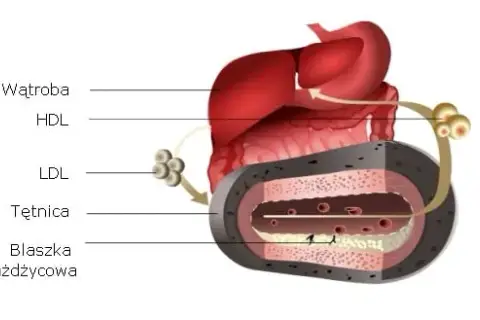 Jak obliczyć cholesterol resztkowy i zrozumieć jego znaczenie dla zdrowia