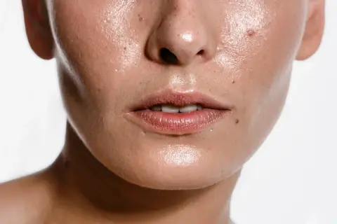 Primer plano de un rostro con piel brillante y húmeda, mostrando poros y pecas. Una imagen que inspira a buscar cómo quitar la grasa de la cara.
