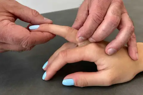 Fizjoterapeuta delikatnie masuje palec po zabiegu, pomagając w rehabilitacji palca trzaskającego.