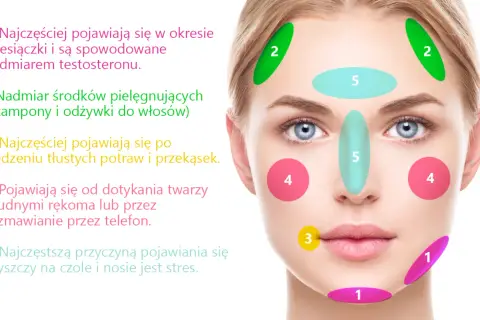 Pryszcze na policzkach: Co oznaczają i jak skutecznie walczyć?