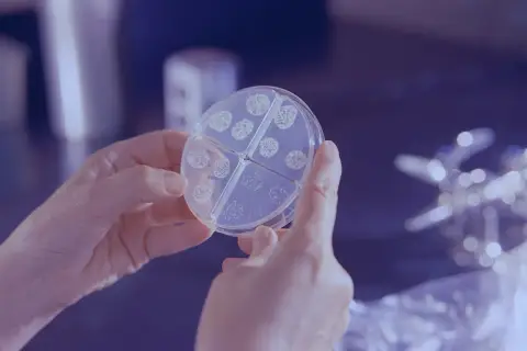 Dłonie trzymają szalkę Petriego z koloniami bakterii, prawdopodobnie Proteus mirabilis, widoczne są podziały na cztery sekcje.