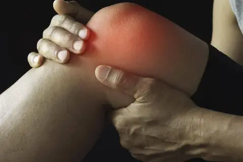 Schmerzendes Knie mit roter Hitze, die auf eine Schleimbeutelentzündung Knie Symptome hinweist. Hände umfassen das Gelenk.