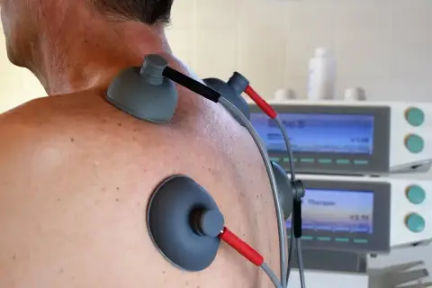 Elektrody TENS na plecach pacjenta. Choć zabieg jest bezpieczny, warto znać potencjalne prądy TENS skutki uboczne.