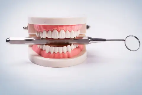 Model szczęki z narzędziem dentystycznym. Zastanawiasz się nad karierą? Sprawdź, jakie są technik dentystyczny zarobki.
