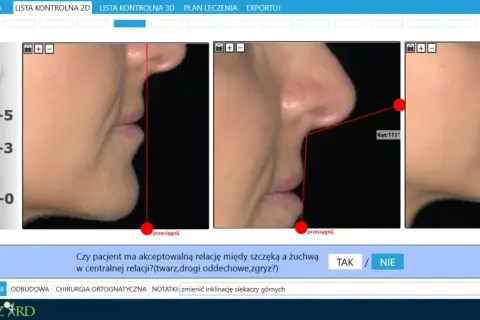 Analiza profilu twarzy: ocena relacji szczęki i żuchwy, czy zęby powinny się stykać. Wyniki pomiarów.