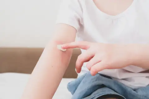 Dziecko smaruje kremem zaczerwienioną skórę na ramieniu, łagodząc objawy azs u dzieci.