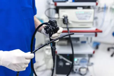 Lekarz w białych rękawiczkach trzyma endoskop. Przygotowania do gastroskopii w znieczuleniu ogólnym.