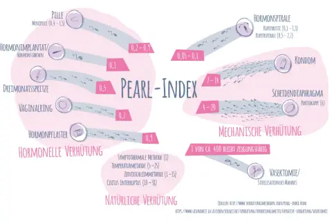 Pearl-Index zeigt Verhütungsmethoden. Die Minipille, eine östrogenfreie Pille, hat einen Index von 0,4-1,5.