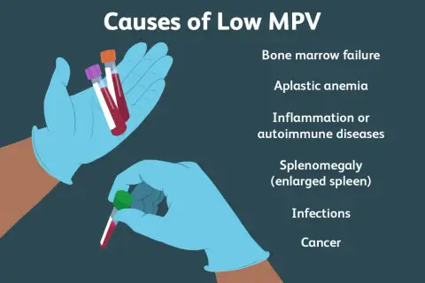 Przyczyny **mpv niskie**: niewydolność szpiku, anemia aplastyczna, choroby zapalne, powiększenie śledziony, infekcje, nowotwory.