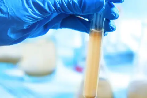 Ręka w niebieskiej rękawiczce trzyma probówkę z mętnym płynem, być może badając obecność nh4.