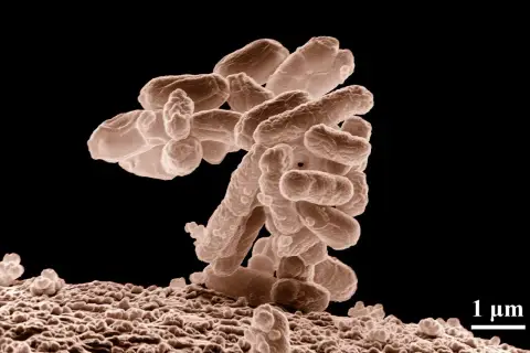 Bakterie na powierzchni, być może pod wpływem erytromycyny, tworzą skupisko. Skala 1 µm.