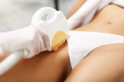 Depilacja laserowa bikini czy boli? Oto co musisz wiedzieć