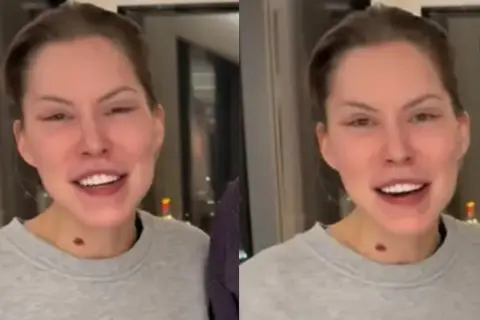 Uśmiechnięta Julia von Stein w szarej bluzie, z charakterystycznym znamieniem na szyi.