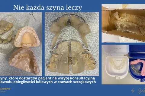 Szyny na zęby, modele szczęk i pudełka na ochraniacze. Pacjent przyniósł je z powodu bólu, co pokazuje, że bruksizm co to za problem, wymaga właściwego leczenia.