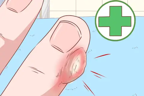 Gros plan d'un doigt enflammé avec une corne sur les mains, entouré d'un symbole médical vert.