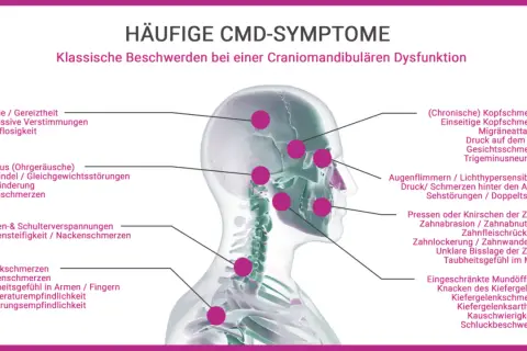 Kopfschmerzen Stirn, Migräne, Druckgefühl am Kopf und Gesichtsschmerzen sind häufige CMD-Symptome.
