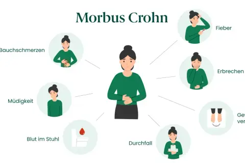 Illustration zeigt typische Morbus Crohn Symptome bei einer Frau: Bauchschmerzen, Müdigkeit, Blut im Stuhl, Durchfall, Fieber, Erbrechen, Gewichtsverlust.