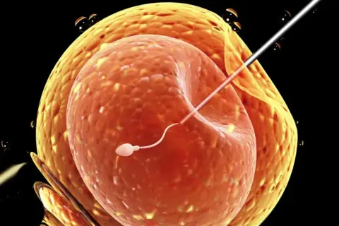 Sperm wstrzykiwany do komórki jajowej, proces wspomagany przez Ovitrelle.