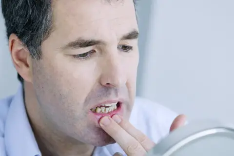 Ból dziąseł: Przyczyny, domowe sposoby i kiedy iść do dentysty