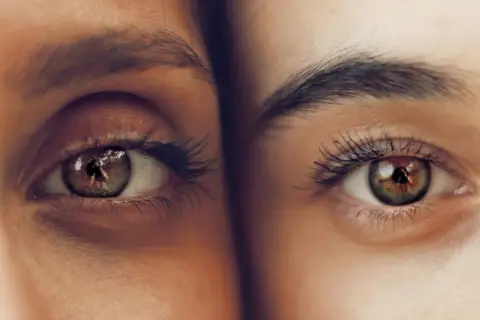 Dos ojos cercanos, uno con ojeras marcadas, el otro más despejado. Reflejan un mundo de detalles.