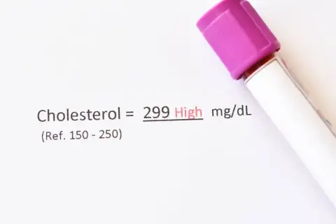Wynik cholesterolu 299 mg/dL, co jest wysokim poziomem. Wskazuje to na potrzebę konsultacji z lekarzem, aby omówić ewentualne zmiany w stylu życia lub leczenie.