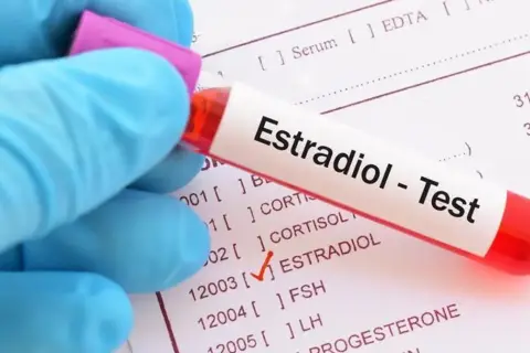 Ręka w niebieskiej rękawiczce trzyma probówkę z napisem "Estradiol - Test". Obok widoczna lista badań, gdzie zaznaczono "ESTRADIOL".