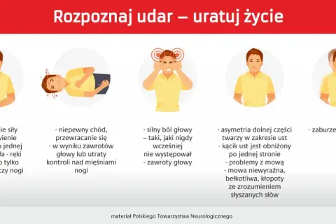Objawy wylewu: osłabienie kończyn, zaburzenia mowy, bóle głowy, problemy z chodzeniem, asymetria twarzy, zaburzenia widzenia.