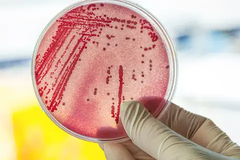 Symptome E. coli: Erkennen Sie die gefährlichen Anzeichen einer Infektion