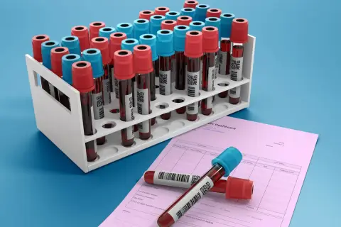 Rząd probówek z krwią, niektóre z czerwonymi, inne z niebieskimi nakrętkami, stoją w białym stojaku. Obok leży różowa faktura ABC Healthcare. Ca 15-3.