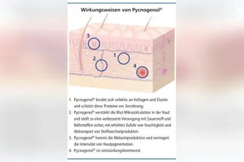 Schema zeigt Pycnogenol Wirkung bei Hautkrankheiten: schützt Kollagen, verbessert Mikrozirkulation, hemmt Pigmentierung, wirkt entzündungshemmend.