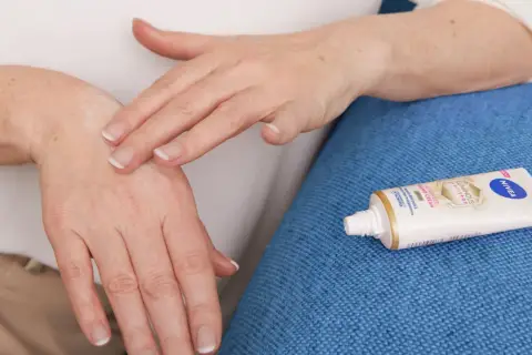 Mani che si applicano crema, forse per alleviare il prurito avambracci cause. Tubetto Nivea in primo piano.