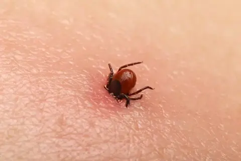 Objawy kleszczowego zapalenia opon mózgowych - nie przegap ich!