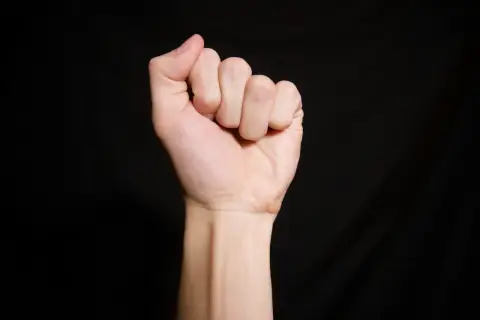 Zaciśnięta pięść z widocznymi krótkimi palcami, co może sugerować brachydaktylię.