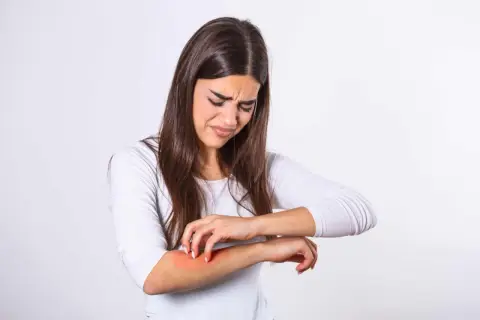 Jakie leki na alergie skórne pomogą Ci w walce z nieprzyjemnymi objawami