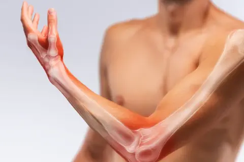Anatomia ręki i przedramienia z widocznymi kośćmi i podświetlonymi obszarami.