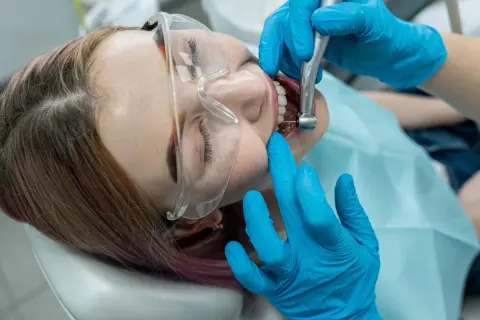 Pacjentka w okularach ochronnych przechodzi leczenie kanałowe. Dentysta w niebieskich rękawiczkach używa wiertła, by ulżyć w bólu zęba.