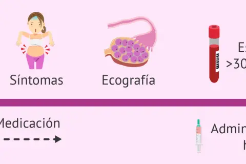 Proceso de donación de óvulos: síntomas, ecografía, medicación, estradiol alto y administración de hCG. A veces, duele donar óvulos.