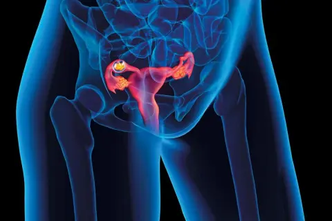 Widok anatomiczny ukazujący macicę w ciąży z widocznym zarodkiem w jajowodzie.