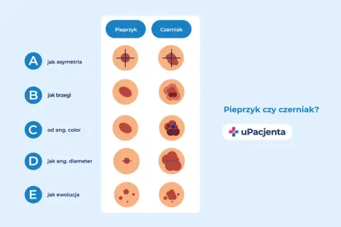 Porównanie cech pieprzyka i czerniaka: asymetria, brzegi, kolor, średnica i ewolucja.