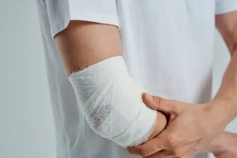 Kiedy zacząć rehabilitację po złamaniu kości ramiennej? Pełny poradnik