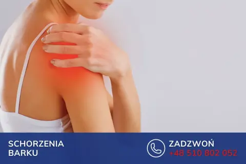 Kobieta z bólem ramienia, objawem zespołu trzaskającej łopatki. Skontaktuj się w sprawie schorzeń barku.