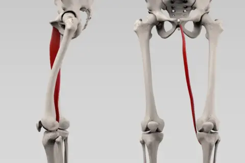 Der musculus gracilis, ein dünner Muskel am Oberschenkel, wird rot hervorgehoben, der vom Becken zum Knie verläuft.