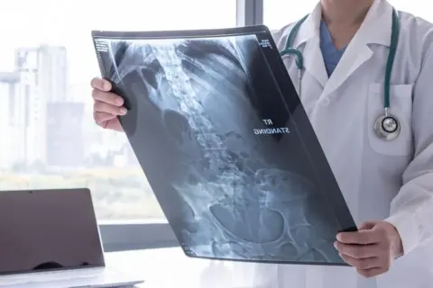 Lekarz analizuje RTG jamy brzusznej, widoczne kręgosłup i miednica.