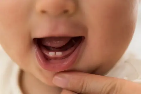 Uśmiech dziecka z dwoma mlecznymi ząbkami. Czas na kolejne, kiedy wypadają mleczne 4?