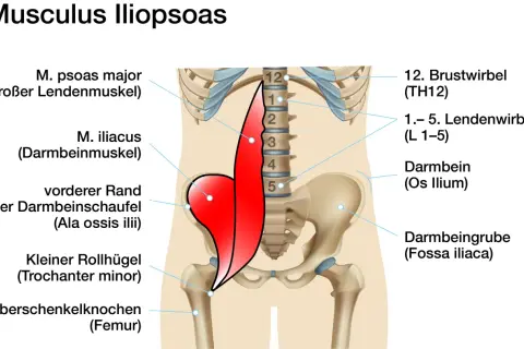 Der Iliopsoas-Muskel, bestehend aus M. psoas major und M. iliacus, ist rot dargestellt. Er entspringt an den Lendenwirbeln und dem Darmbein und setzt am Oberschenkel an.