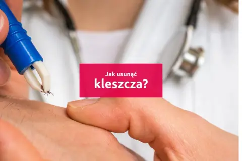 Usuwanie kleszcza specjalnym przyrządem. Tekst: "Jak usunąć kleszcza?".